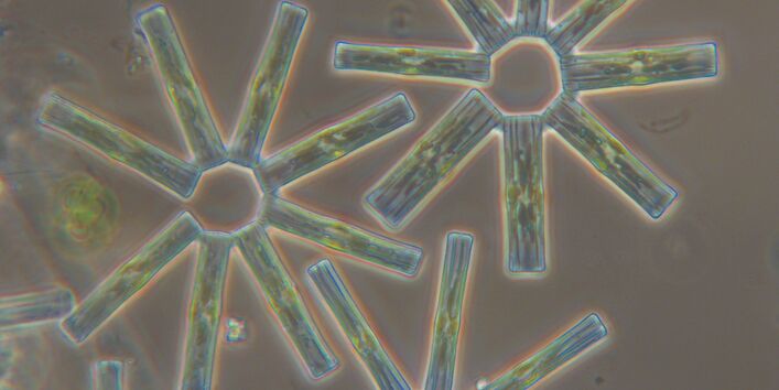 Eine Mikroskopaufnahme der Kieselalge Tabellaria flocculosa
