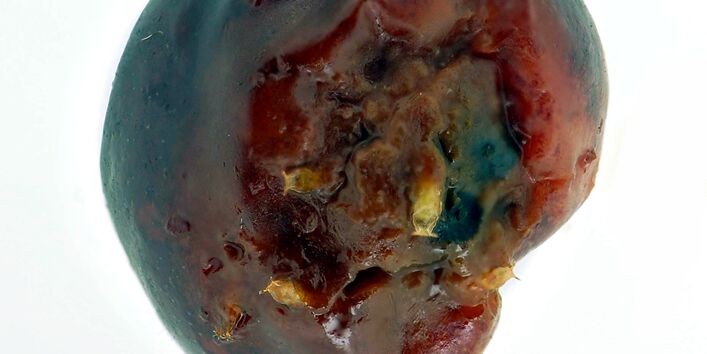 Kirsche mit Made der Kirschessigfliege.