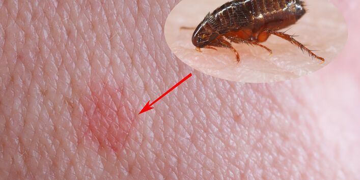 gerötete Haustelle nach Flohstich