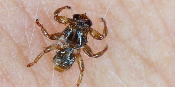 Hirschlausfliege sitzt auf menschlicher Haut