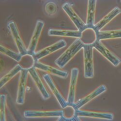 Eine Mikroskopaufnahme der Kieselalge Tabellaria flocculosa