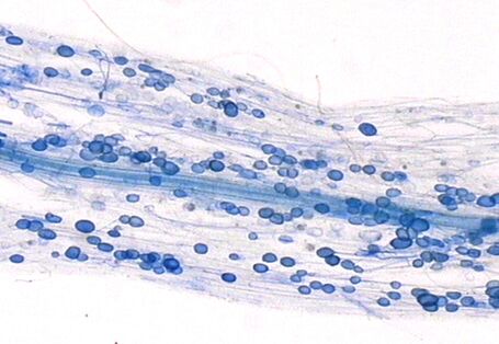 Hier sieht man die Symbiose zwischen Pilzen und Pflanzen: Mykorrhiza. In einer Wurzel sind mal blau angefärbte Punkte
