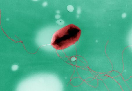 Das Bakterium Escherichia coli des Serotyps