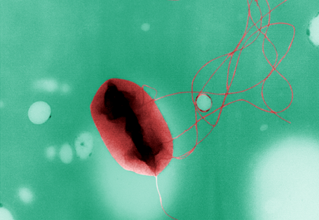 Bakterium Escherichia coli des Serotyps 0157 mit sogenannten Flagellen (Geißeln) zur Fortbewegung