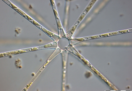 Mikroskopaufname vom Schwebesternchen