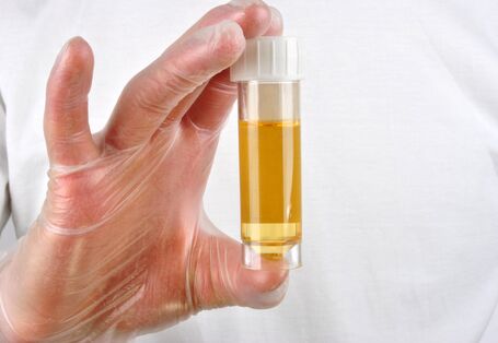 Behandschute Hand hält Glasröhrchen mit Urin