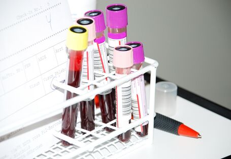 Blutproben in einem Ständer, daneben ein Laborbericht und ein Kugelschreiber