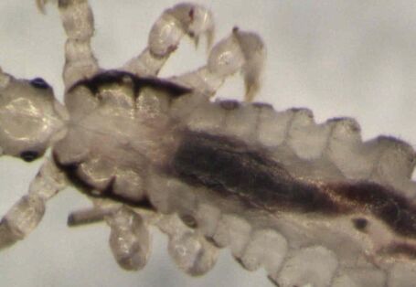 Eine Kopflaus, stark vergrößert