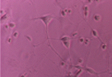 Mikroskopische Aufnahme: mit Differenzierungsfaktor behandelte Zellen