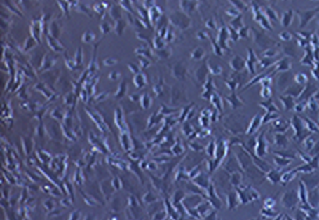 Mikroskopische Aufnahme: unbehandelte Nervenzellen