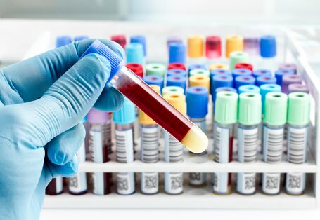 Blutprobe im Reagenzglas