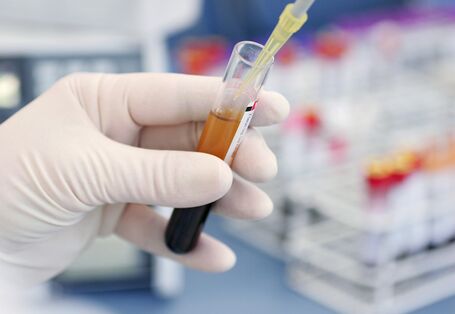 Person in Laborkleidung hält ein Reagenzglas mit Blut und verwendet eine Mikroliterpipette zur Probenentnahme