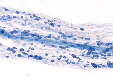 You can see the symbiosis of funguses and plants: mycorrhiza. There are blue-coloured dots in one root.