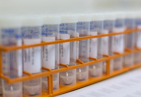 Probenröhrchen in einem Gestell