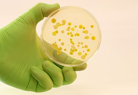 Nahaufnahme von Bakterienkolonien auf einem Nährboden in einer Petrischale