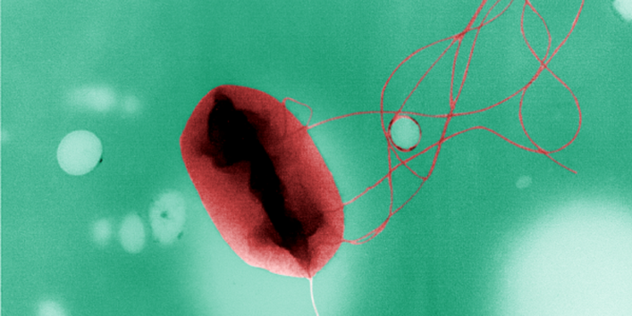 Bakterium Escherichia coli des Serotyps 0157 mit sogenannten Flagellen (Geißeln) zur Fortbewegung