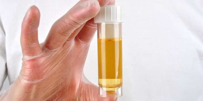 Behandschute Hand hält Glasröhrchen mit Urin