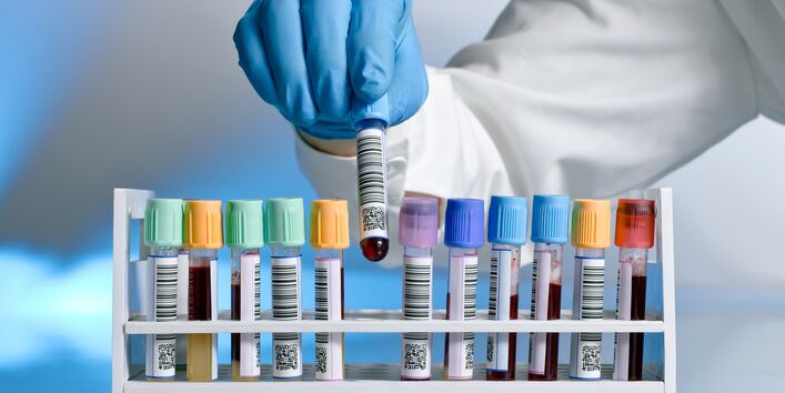 verschlossene und mit einem Barcode-Aufkleber versehene Plastikgefäße mit Blutproben in einem Ständer, ein Mensch im weißen Kittel und mit Gummihandschuhen nimmt ein Gefäß aus dem Ständer