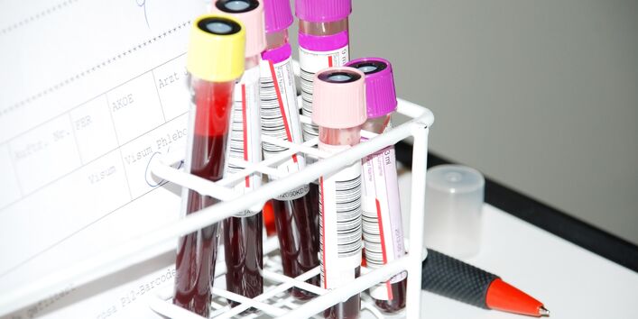 Blutproben in einem Ständer, daneben ein Laborbericht und ein Kugelschreiber