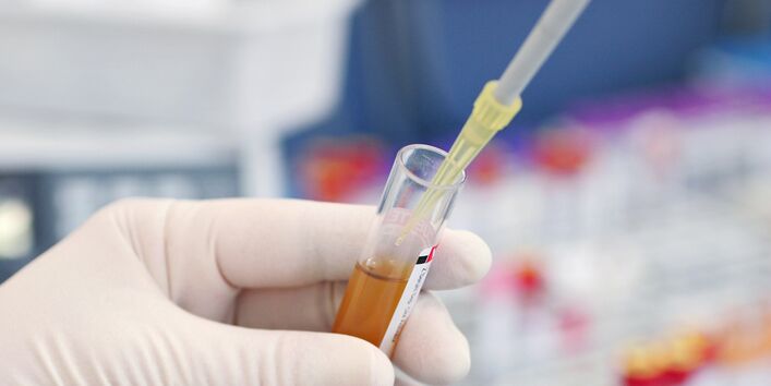 Person in Laborkleidung hält ein Reagenzglas mit Blut und verwendet eine Mikroliterpipette zur Probenentnahme