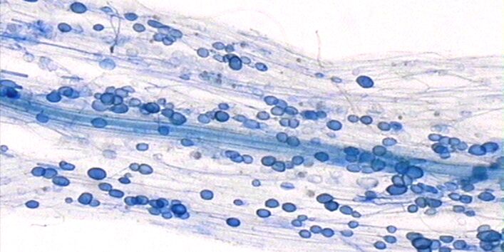 You can see the symbiosis of funguses and plants: mycorrhiza. There are blue-coloured dots in one root.